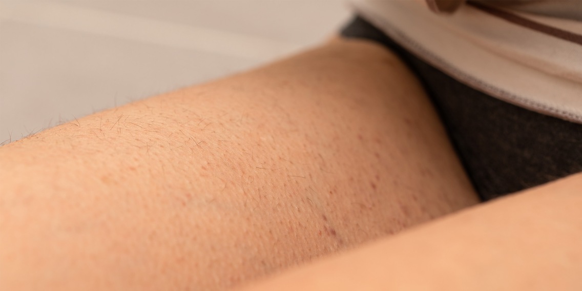 5 Tipps gegen Pickel nach der Intimrasur - Galaxus
